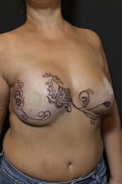 Sœurs d’Encre tatoueuses Rose Tattoo tatouage cancer du sein 08