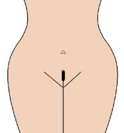 Brazilian Landing Strip Haarentfernung bei Pérola Brasil Waxing und Beautystudio