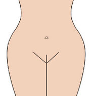 Hollywood Haarentfernung bei Pérola Brasil Waxing und Beautystudio