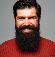 beard-transplant