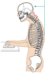 頭部や肩の位置、姿勢を改善してコリの改善に導きます