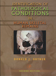 『Identification of Pathological Conditions in Human Skeletal Remains』