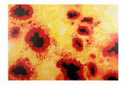 Taches solaires (Acrylique sur toile - 130 x 88 )