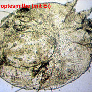 Sarcoptesmilbe
