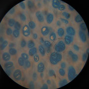 A6. Cartilagine ialina.