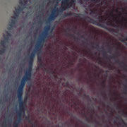 A14. Intestino tenue.