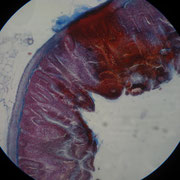 A14. Intestino tenue.