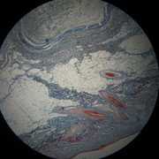 A2. Cuoio capelluto.