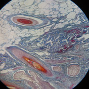 A2. Cuoio capelluto.
