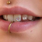 Zahnschmuck Kassel Beispiel 3