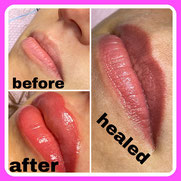 Permanent Make Up Lippen, Hamburg, Norderstedt, vorher - nachher, Lippenkontur, Schattierung, abgeheilt