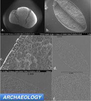 seed coat thickness synchrotron 