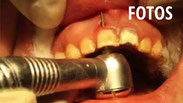Schräge Fotos aus der Zahnmedizin