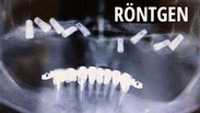 Skurrile zahnmedizinische Röntgenbilder