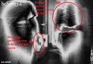 5 - Negativo Dettaglio Anomalia RX Lastra