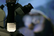 Trattamenti endodontici in Microscopia