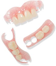 ハンドメイド 入れ歯 ノンクラスプデンチャー ノンクラスプデンチャー Non-Clasp Denture ::::: デンチャー