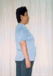 ダイエット前