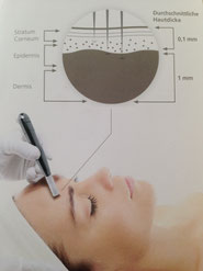 Microneedling in Basel für sichtbare Hautergebnisse!