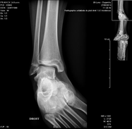 radiologie imagerie médicale IRM scanner