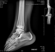 radiologie imagerie médicale IRM scanner