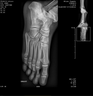 radiologie imagerie médicale IRM scanner