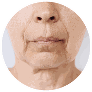 Sonnenschutz gegen Falten