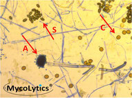 MycoLytics - Aspergillus, Chaetomium in Direktmikroskopie,Kultivierung, Schimmelpilze, Bakterien, Holzzerstörer, Luft-, Staub-, Materialproben 