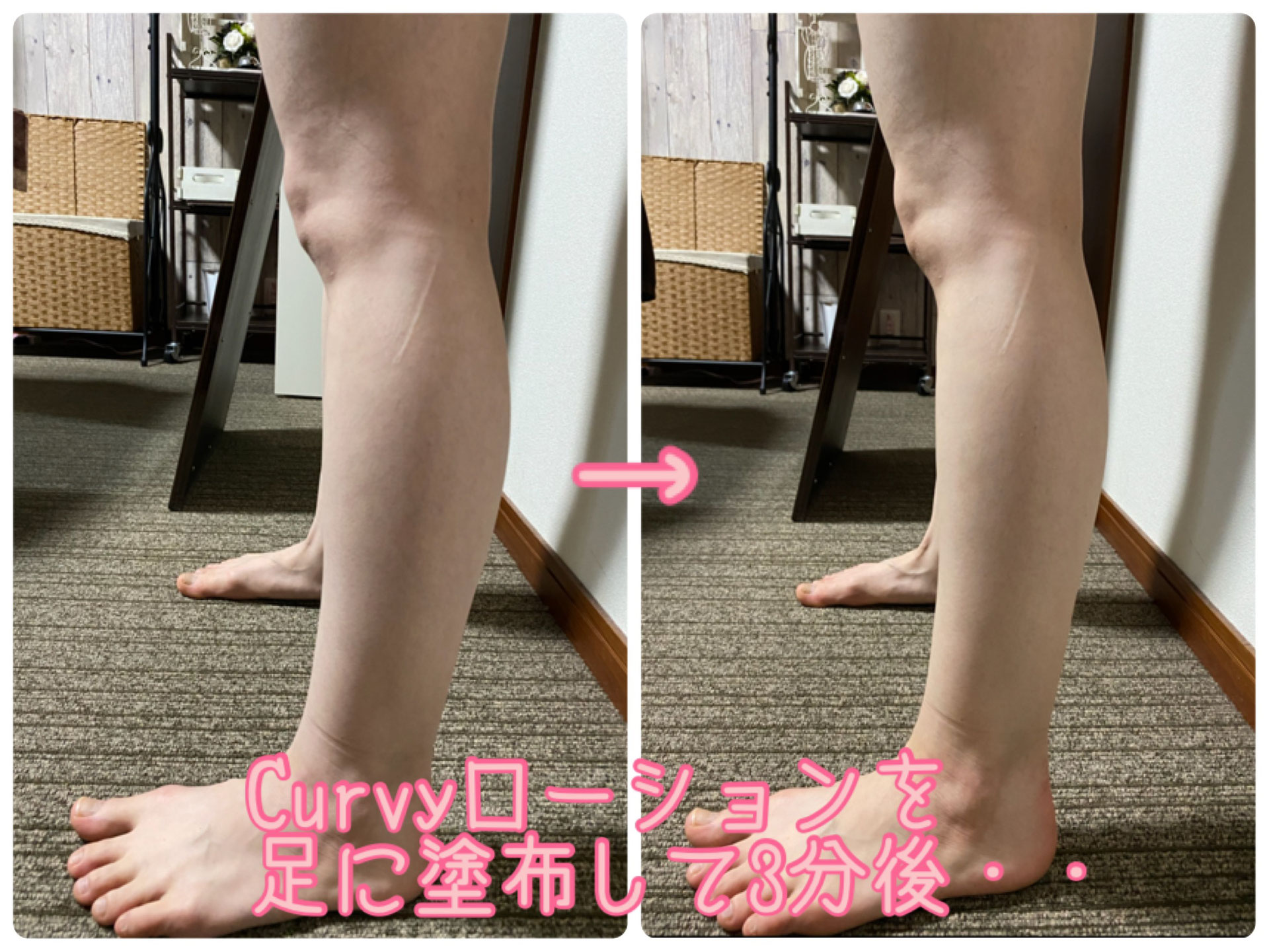 足の疲れ むくみ だるさに ニキビ たるみ 小顔の肌改善専門エステサロン リトハピ 足の疲れ むくみ だるさに ニキビ たるみ 小顔の肌改善専門エステサロン リトハピ