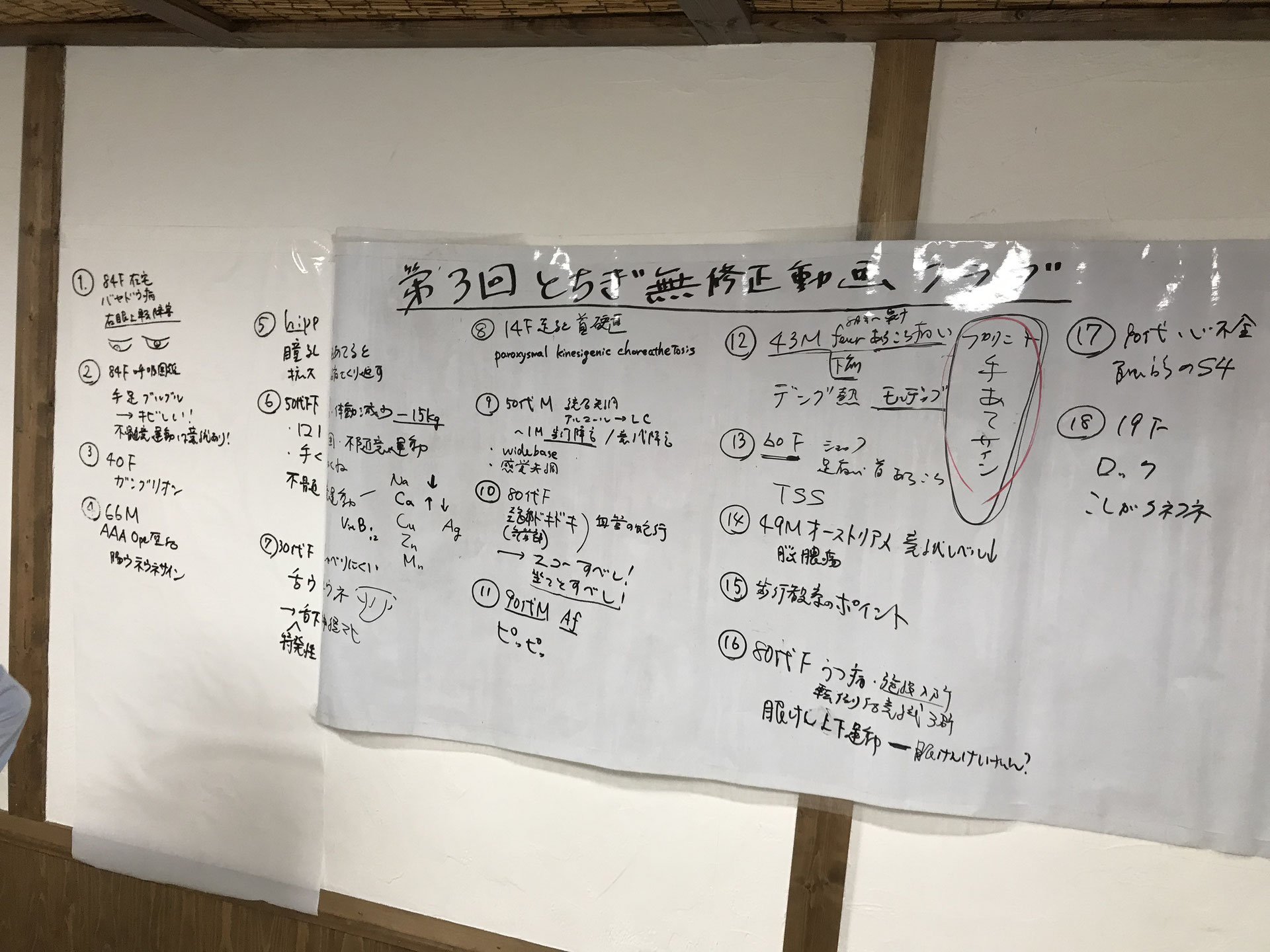 80代女性 右眼が上転しない ーバセドウ病眼症ー 医師 看護師 全ての医療人のための身体診察ワークショップ 80代女性 右眼が上転しない ーバセドウ病眼症ー 医師 看護師 全ての医療人のための身体診察ワークショップ