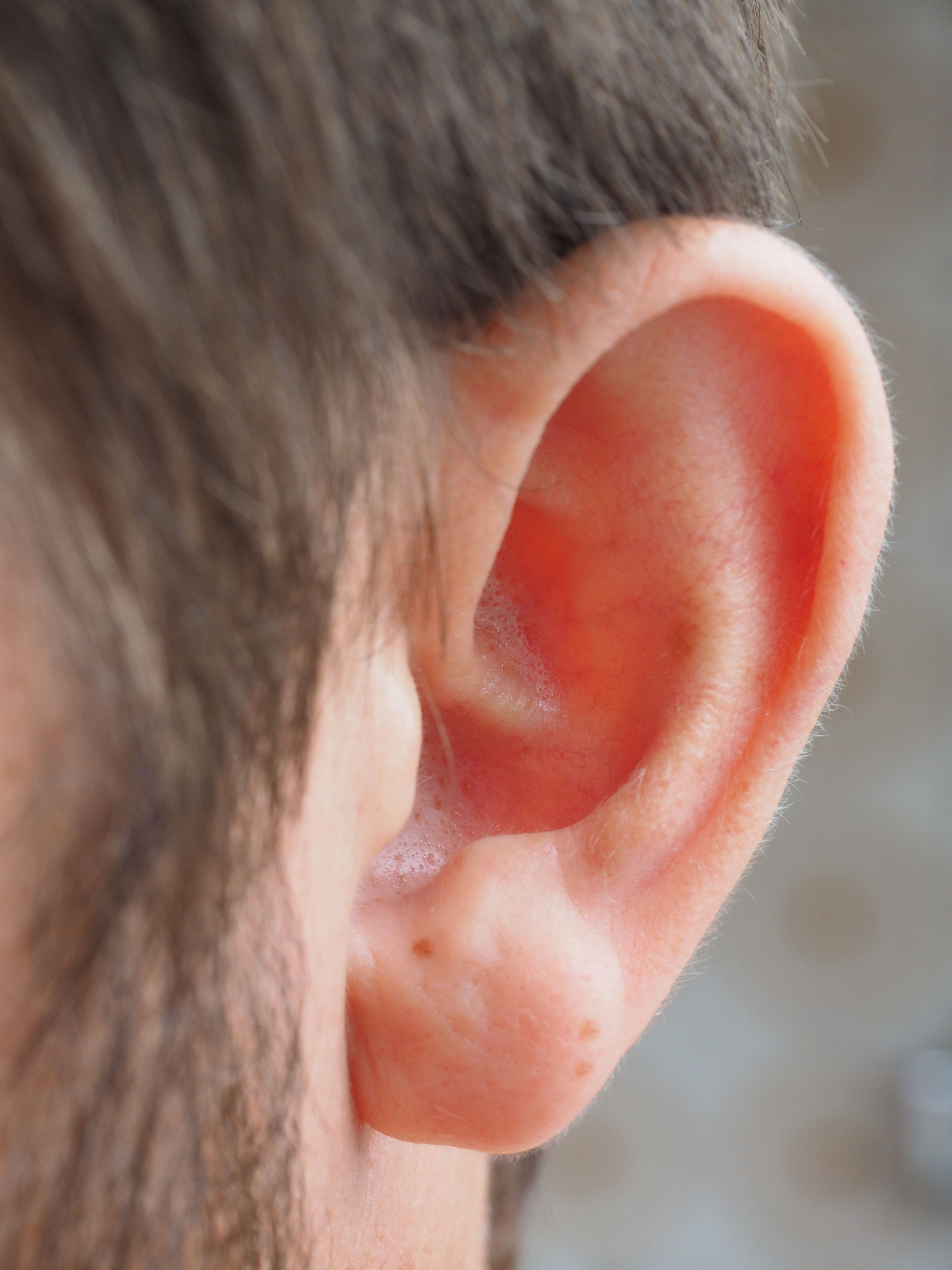 Tinnitus – was Sie wissen sollten! - Apotheke Helmstedt