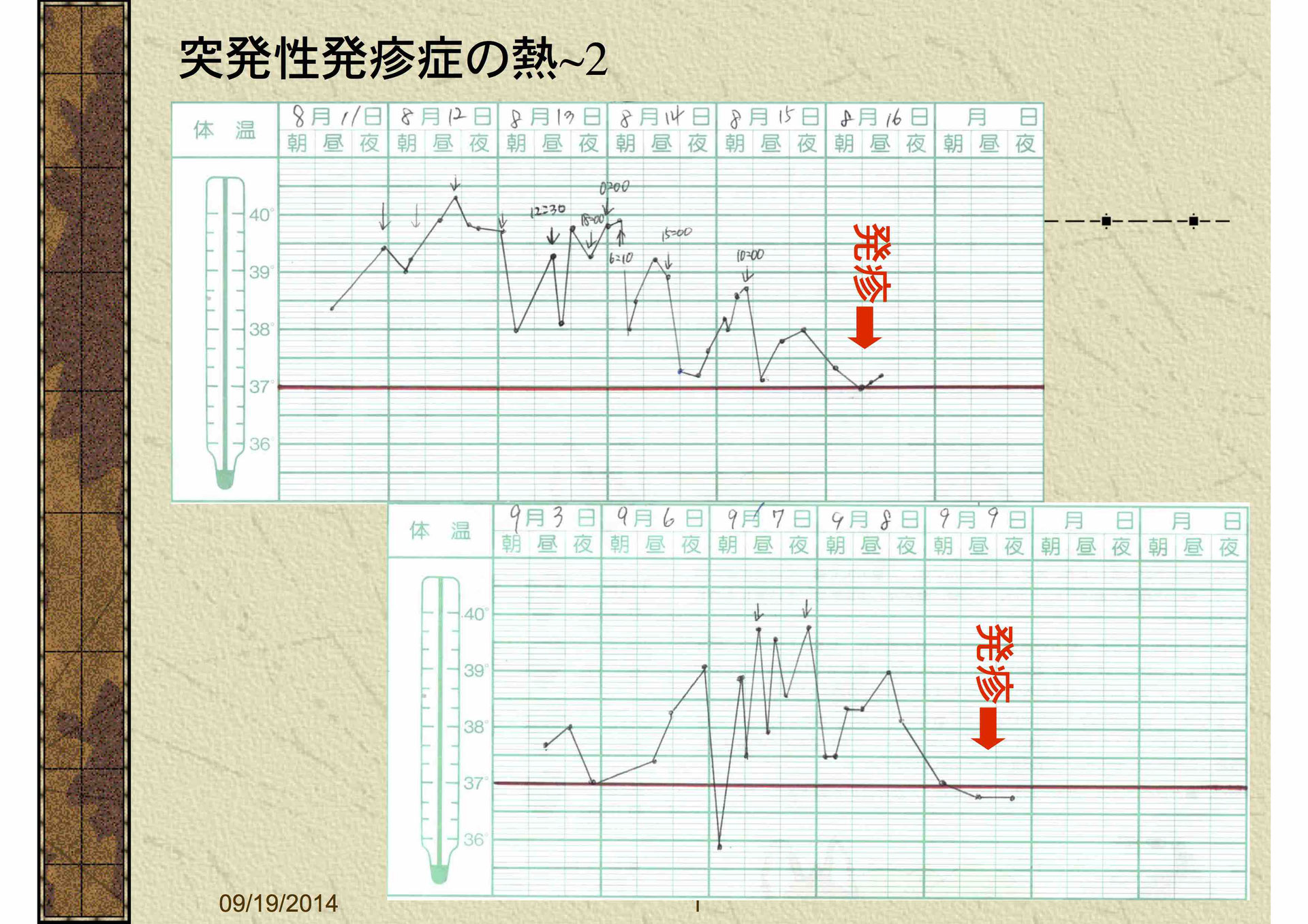 発疹 突発 性 東京都こども医療ガイド