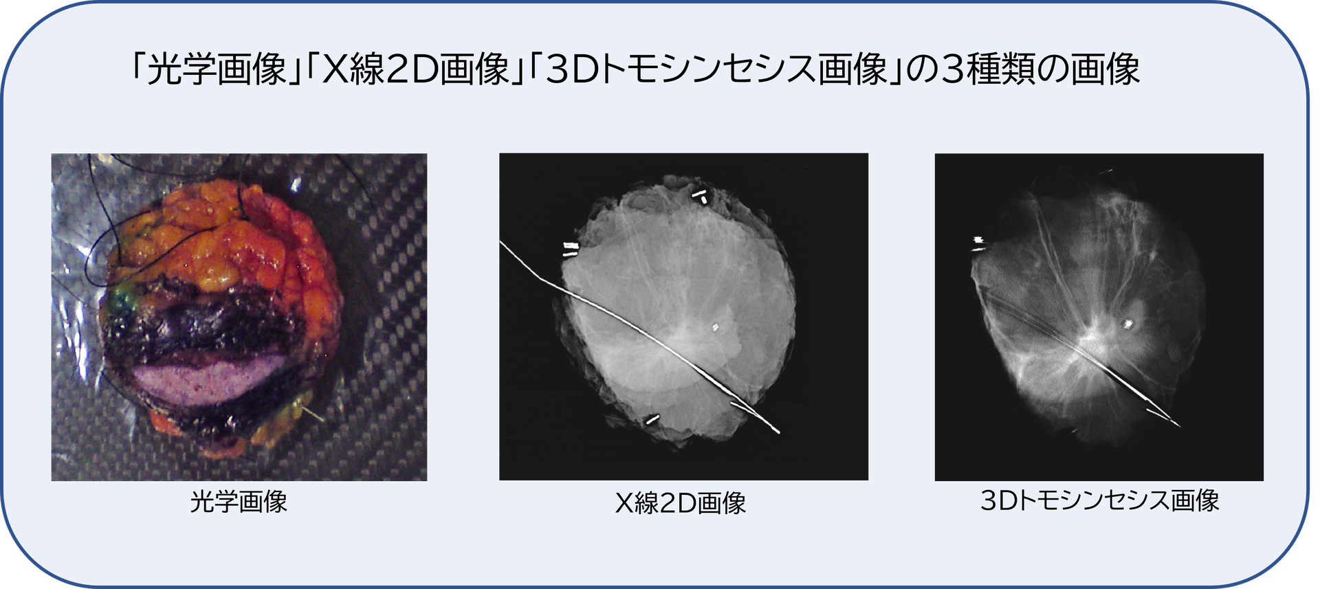 MOZART 病理検体トモシンセシス画像システム - 株式会社クロノス