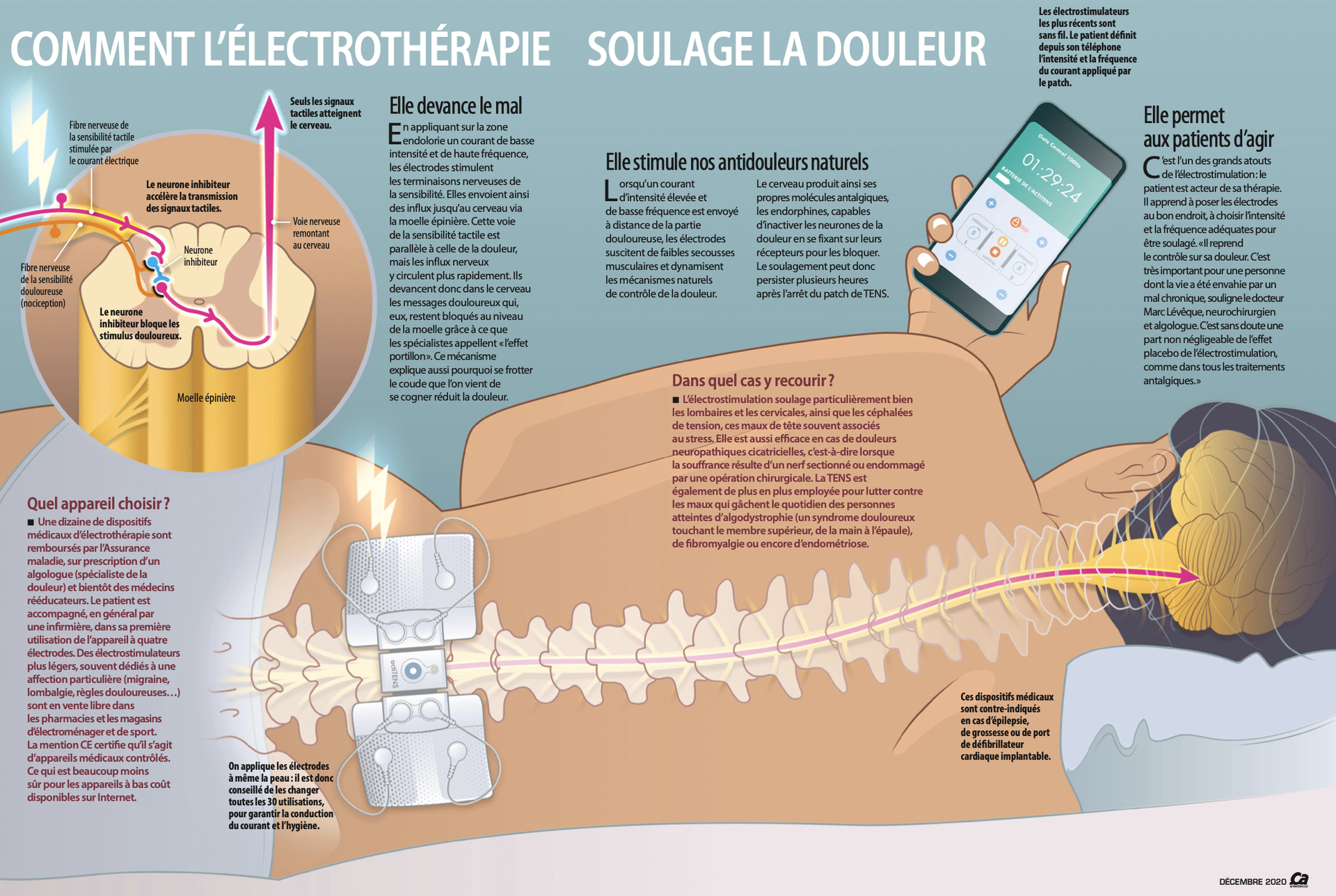 Quels Sont Les Effets D un Défibrillateur Sur Le Corps Schéma TENS - Neurochirurgien Marseille Aix-en-Provence
