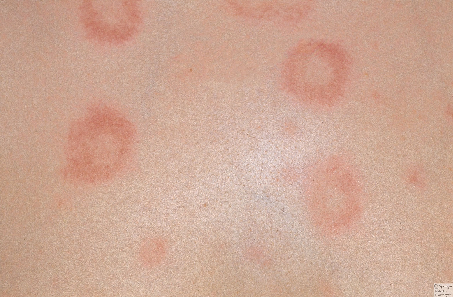 Kinderkrankheiten Grosskleins Webseite