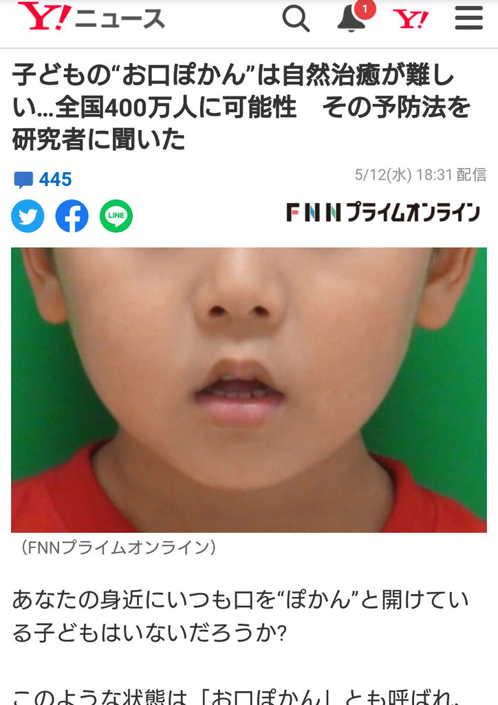 お口ぽかん 京都で歯周病 白い歯なら林歯科