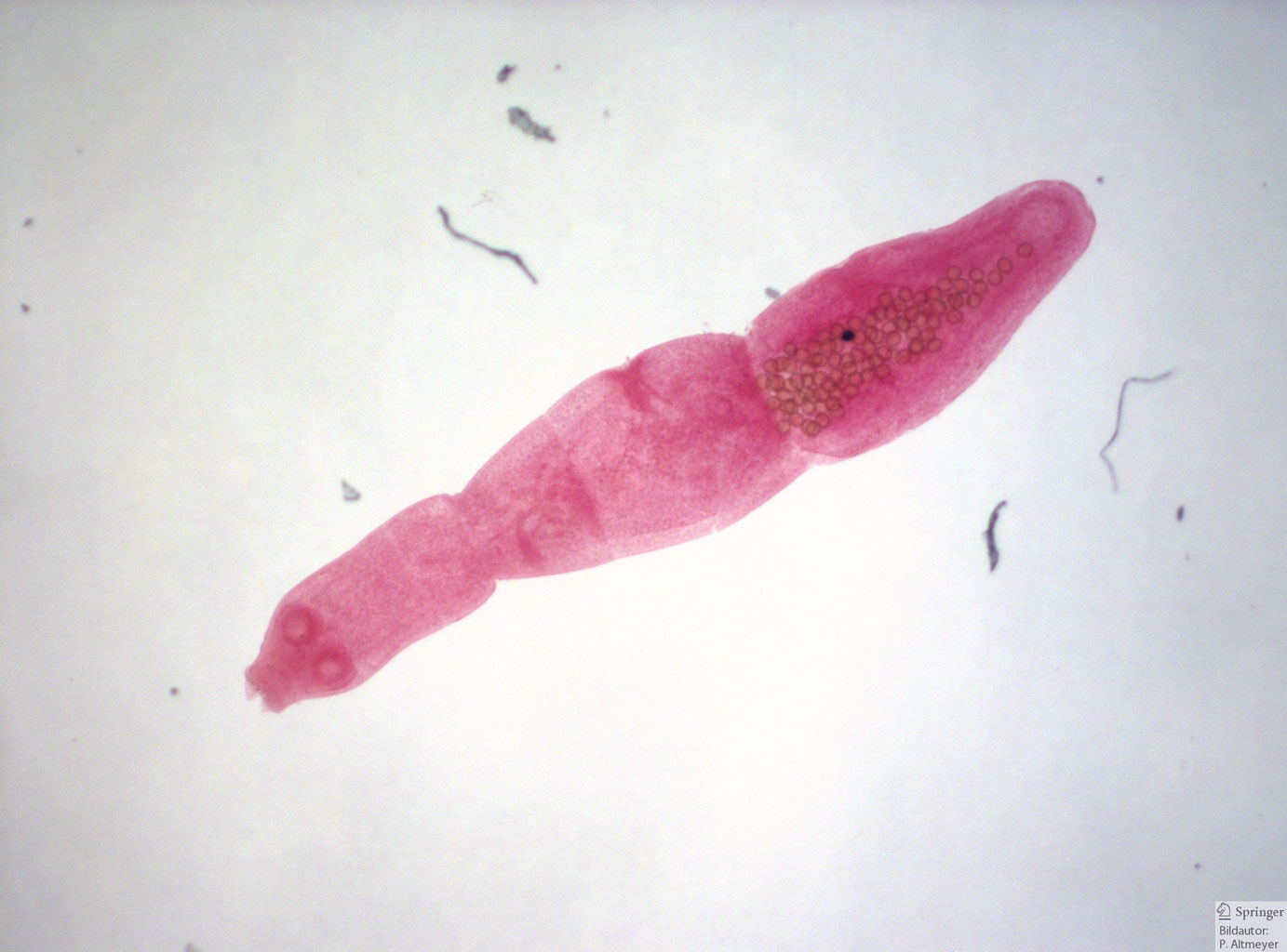 Echinokokkos detaelisats Webseite!