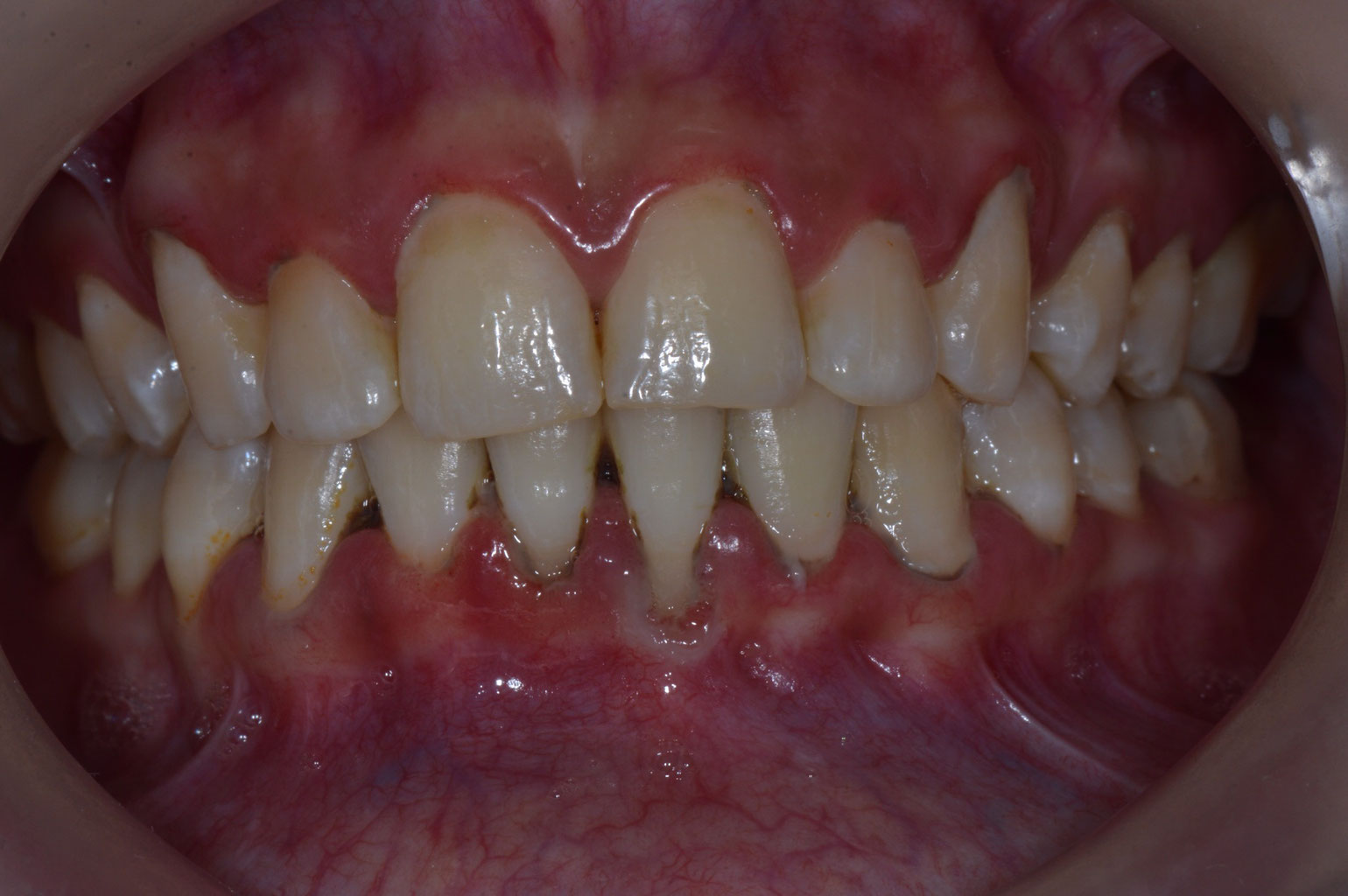 Te Ha Sucedido Encias Oscuras Dentista En Chimbote Y Nuevo Chimbote