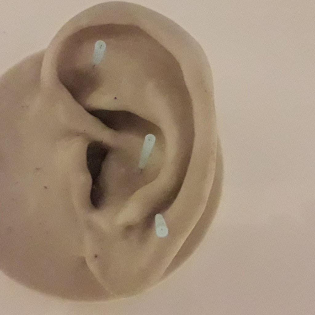 Akupunktur - praxisneidhardt, praxis dr. neidhardt, praxis ...