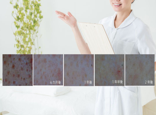 KOKOROが目指す美しさ：美しさの原点「健康な肌」です。スコープで確認でます。