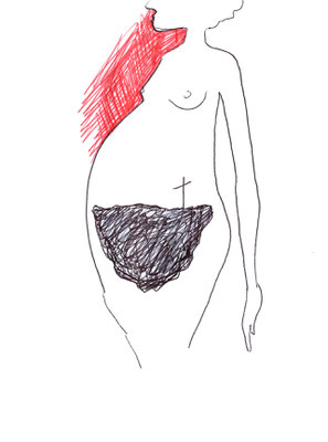 Deuil de l'enfant biologique