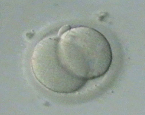 Origin_Mitose_Sinnkoerper