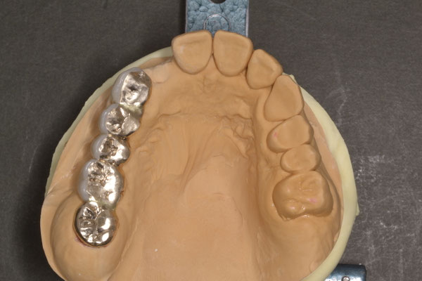 歯科 - HAGI dental lab