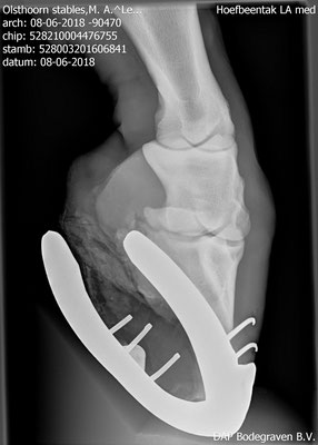 Hoefbeentak LA med 8-6-18