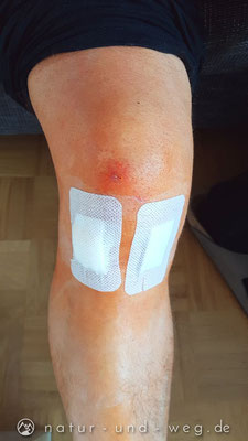 Knorpelschaden Im Knie Und Nun Natur Und Weg