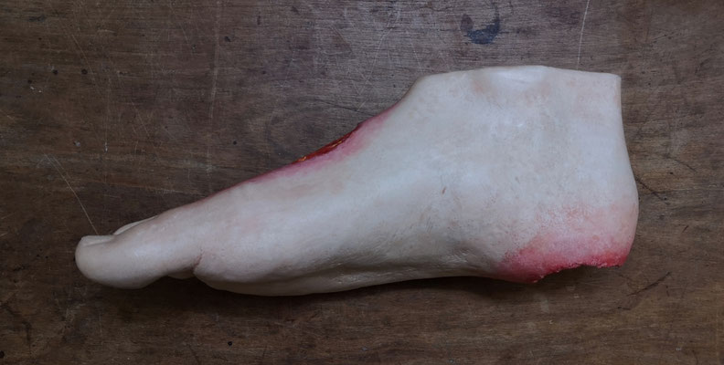 Modèle de plaies chroniques  - Chronic wounds model