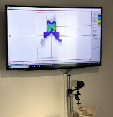 Die Satteldruckmessung mit 64 Sensoren zeigt genau auf, ob der Sattel richtig eingestellt ist und zur Anatomie des Beckens passt