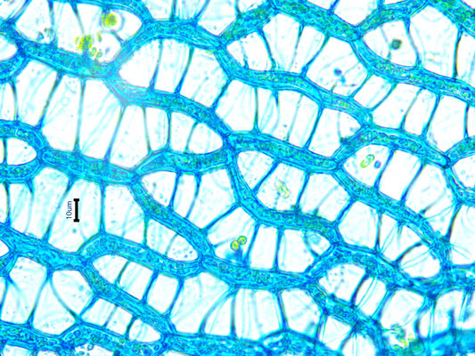 Bild 17 Astblattzellen konkave Seite