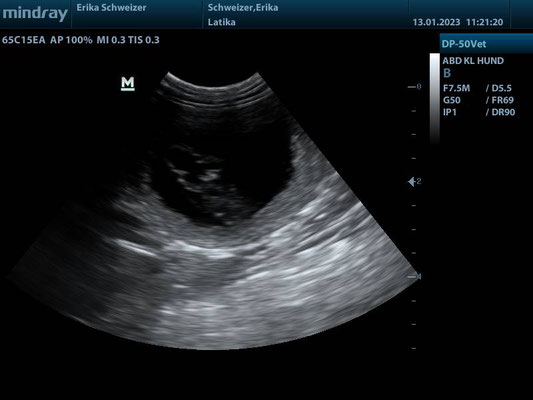 ZUltraschall Echographie 4 Wochen-semaines