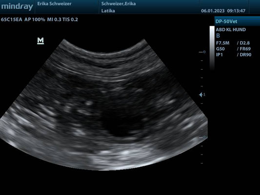 Ultraschall Echographie 3 Wochen-semaines